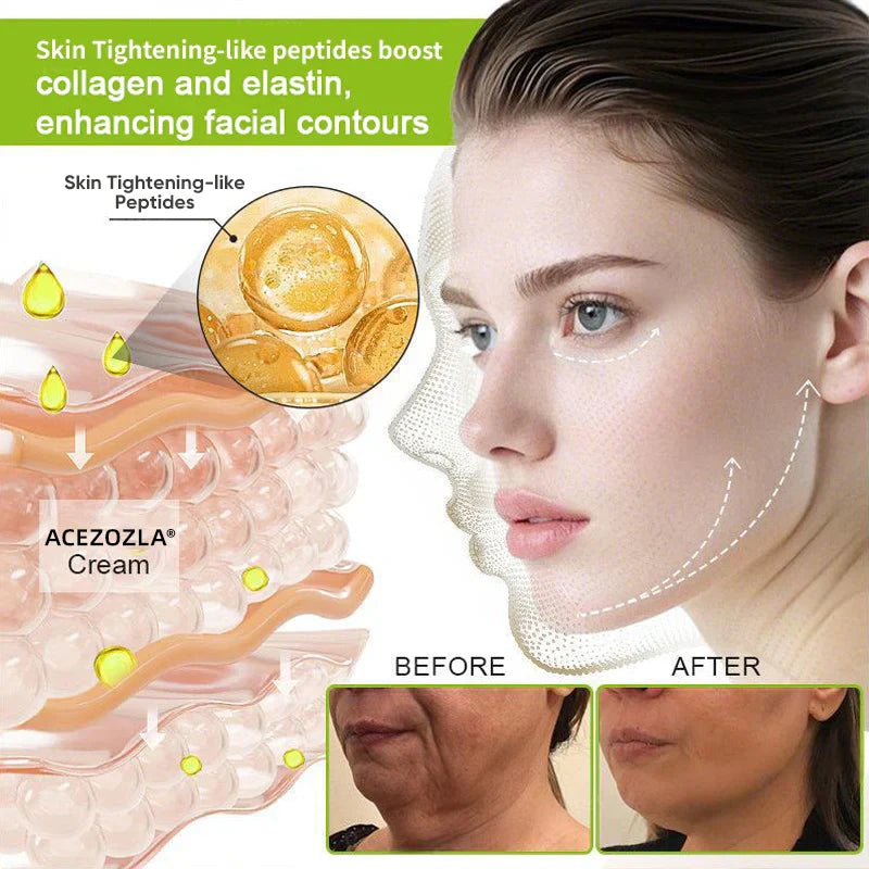 ✨Final 3 Hours: 70%OFF🔥Acezozla™ Botulinum & Vita-A Retinol Shot Wrinkle-Lift Tightening cream✨